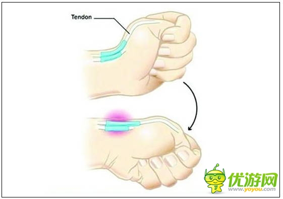 玩手機(jī)易患十大“智能手機(jī)病” 這些癥狀你都有嗎？